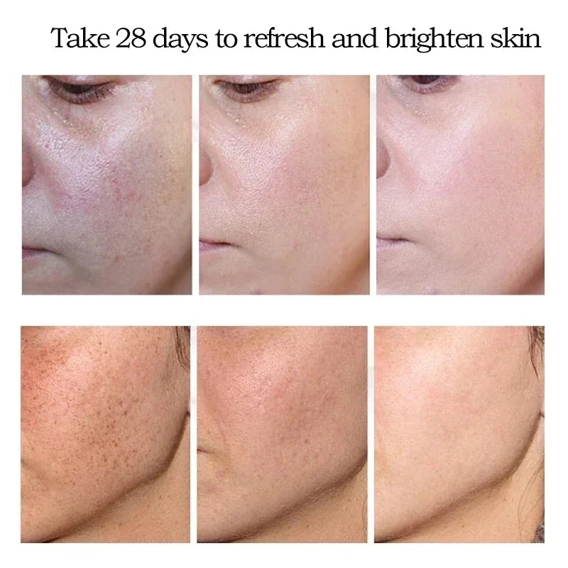 Dark Spot Remover Cream for Women - Melasma & Freckles Fading, Skin Brightening Care